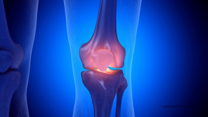 Chronic Inflammation